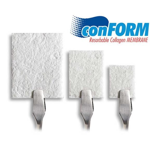 CONFORM MEMBRANA REABSORBIBLE COLAGENO 15X20MM