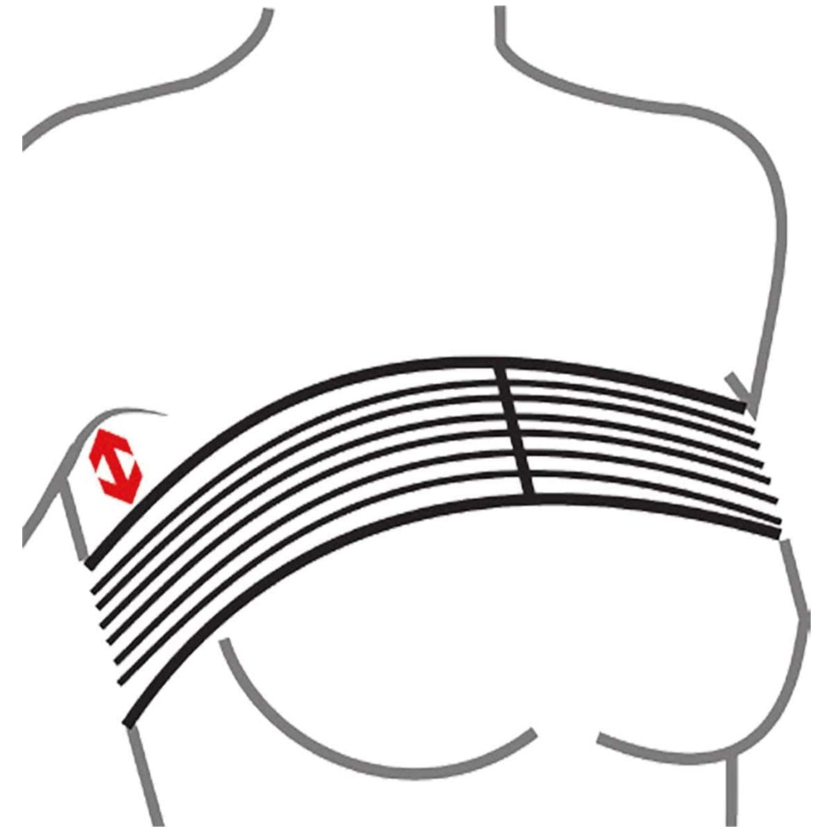 BANDAS ESTABILIZADORAS DE IMPLANTES - BLANCO