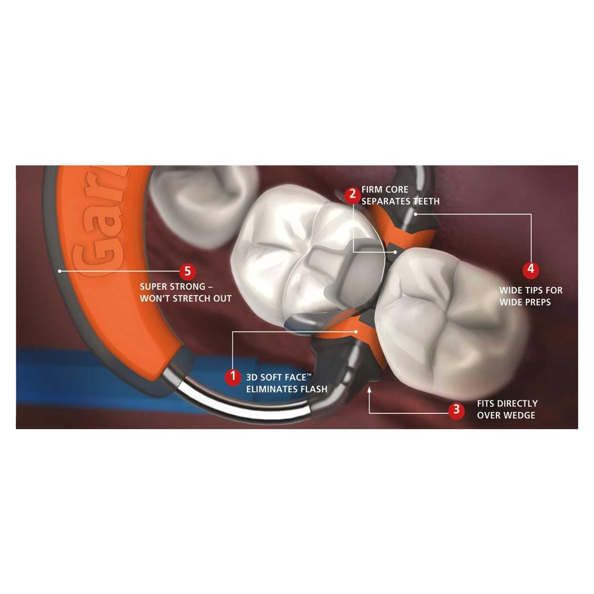 COMPOSI-TIGHT 3D REP BANDA M050 50U - GARRISON