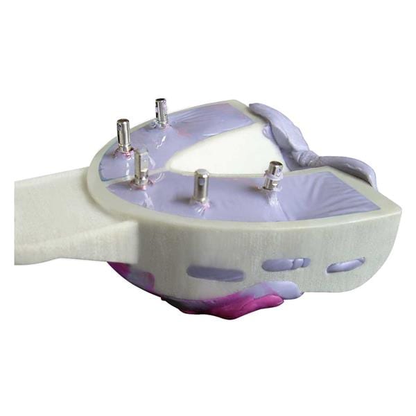 CUBETA INDIVIDUAL MIRATRAY IMPLANTES INTRO KIT 6U- HAGER & WERKEN
