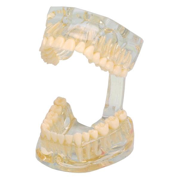 MODELO DENTAL TRANSPARENTE 1U - HAGER & WERKEN