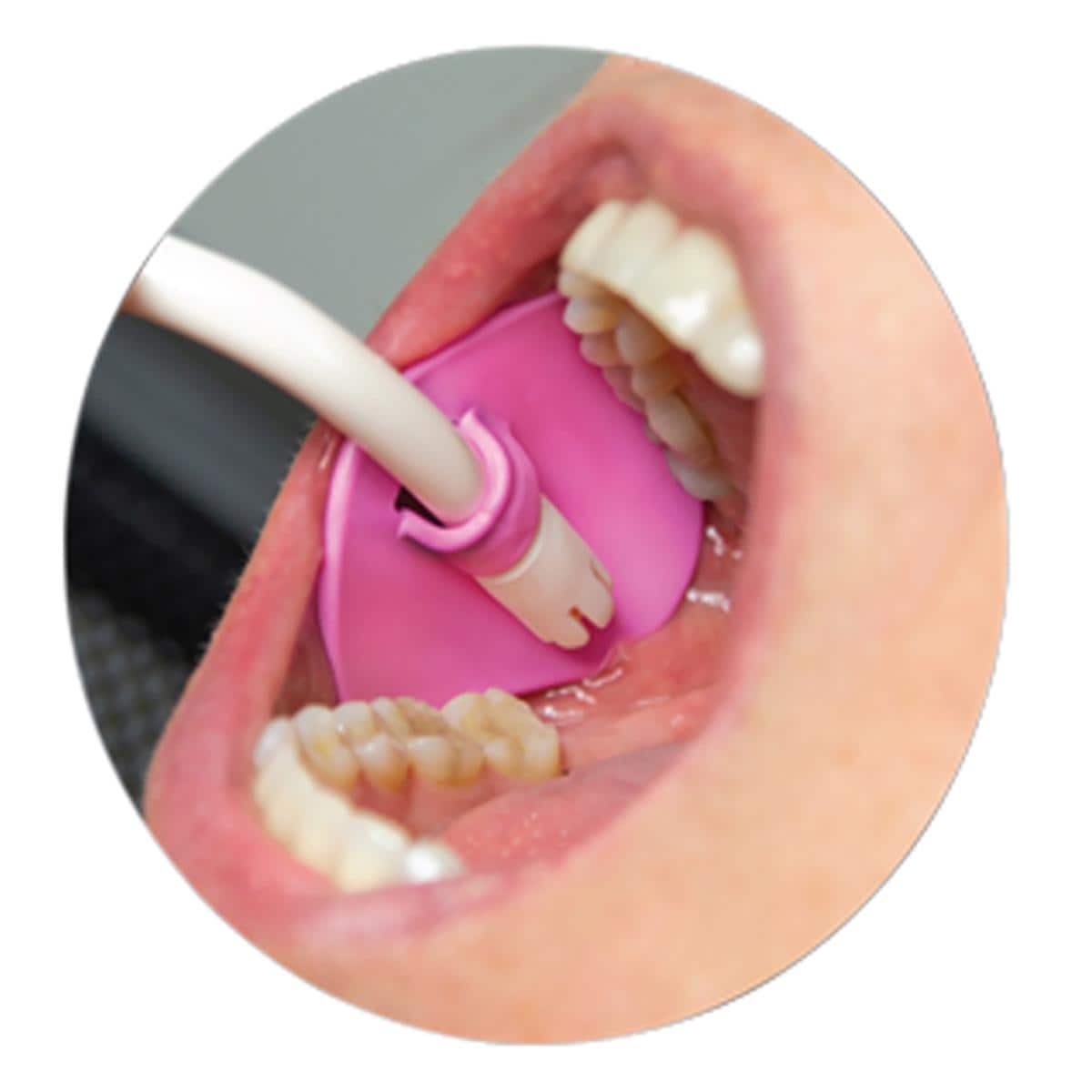 PINK PETAL SOPORTE EYECTOR 100U - ZIRC