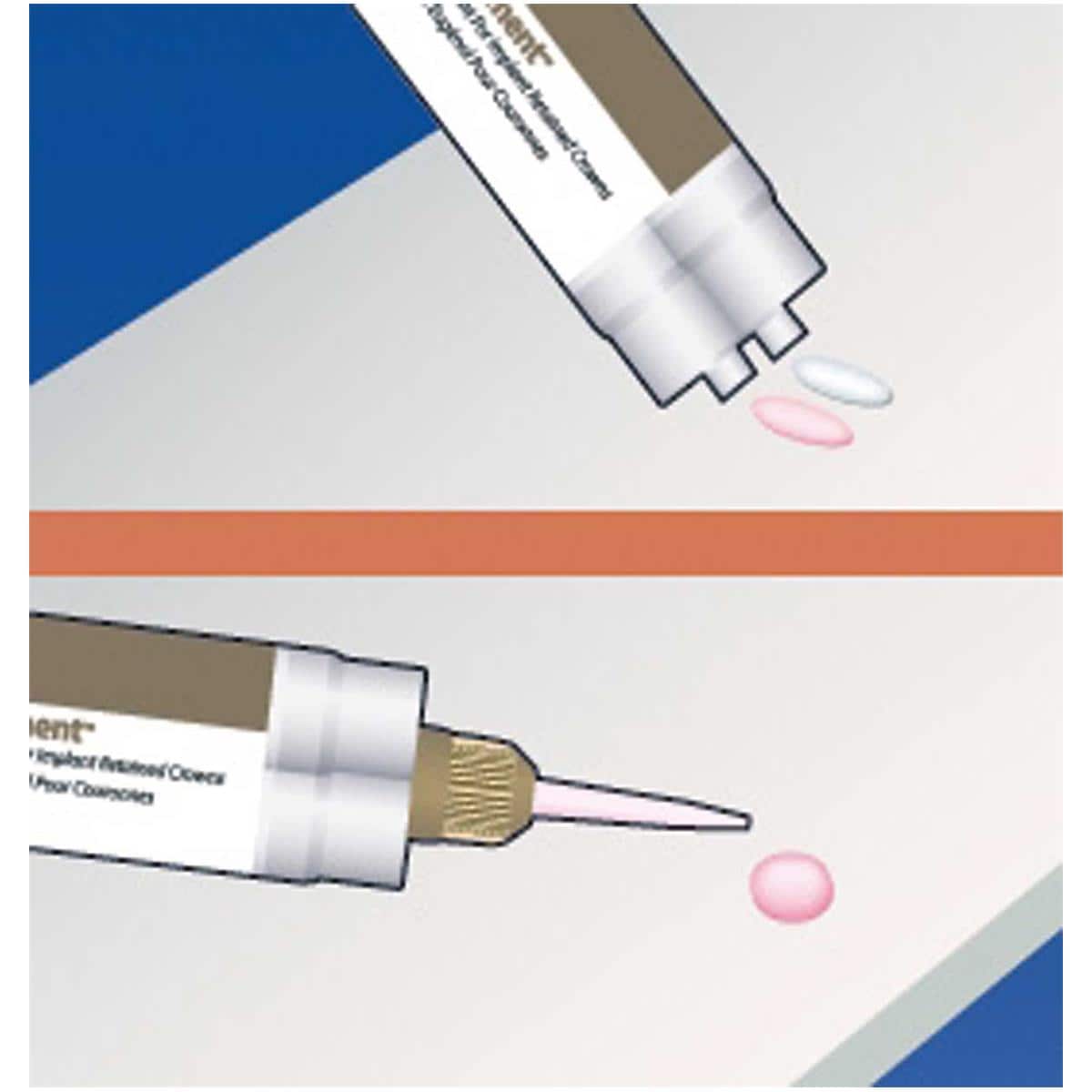 PUNTAS MEZCLA CEMENTO IMPLANTES 25U- PREMIER