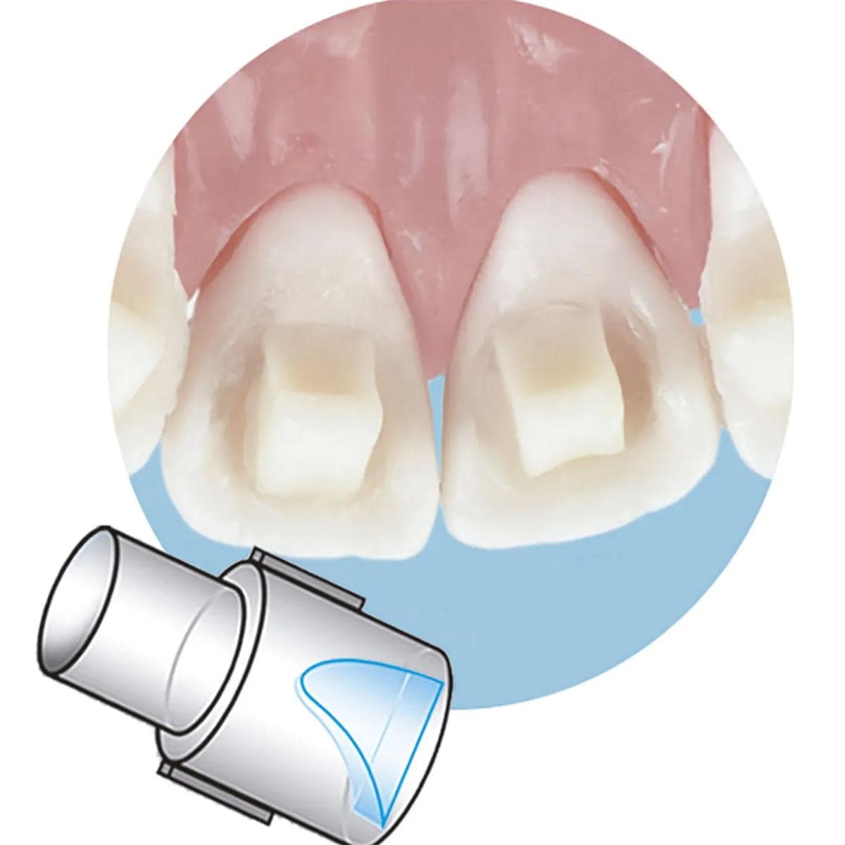 REPOSICIÓN MINIMOLDE BITE-RAMP LARGO 10U + MANGO - SIA
