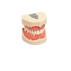 TIPODONTO ANKA4 - FRASACO