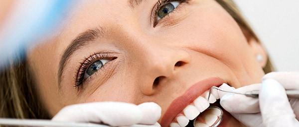 PROFILAXIS DENTAL / ODONTOLOGÍA