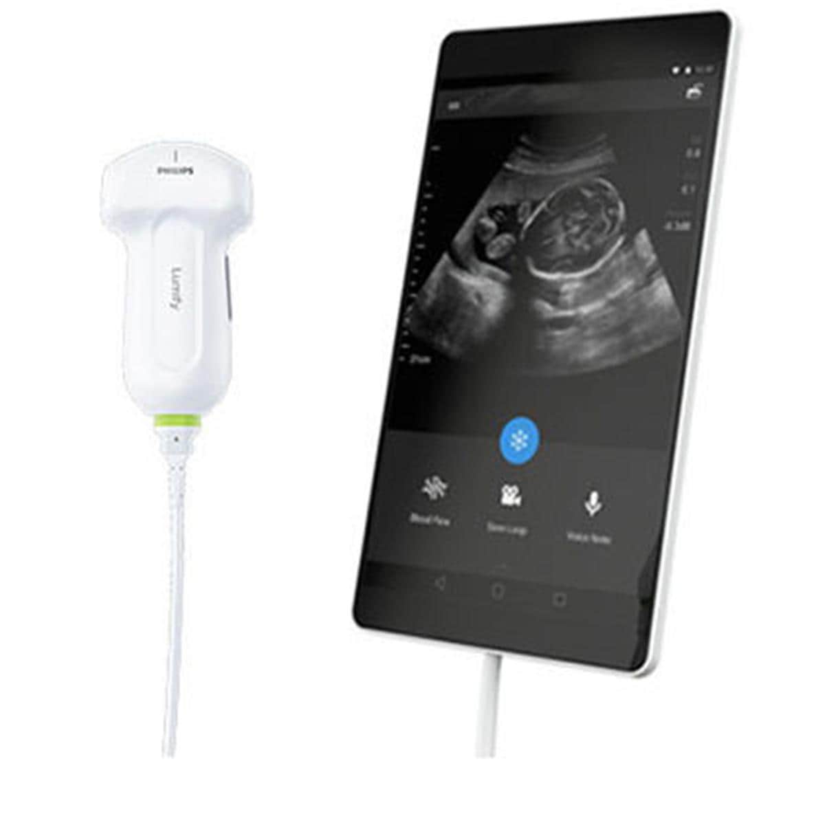 ULTRASONIDOS LUMIFY CON SONDA CONVEXA C5-2 PHILIPS