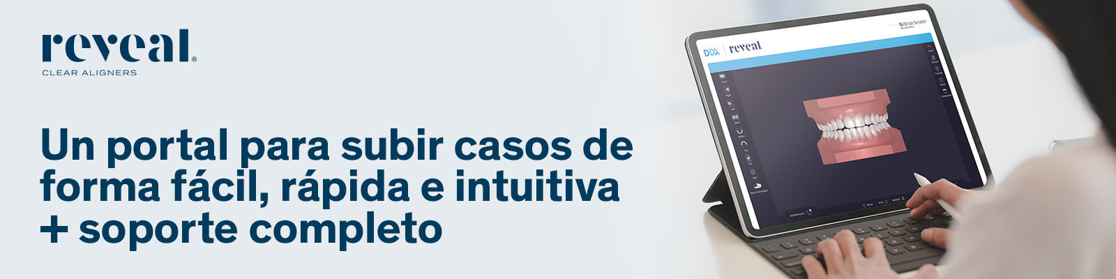Ortodoncia invisible Reveal Clear Aligners: simple y claro