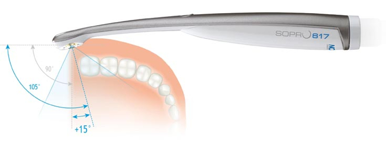 Ángulos posibles con la Cámara intraoral Sopro 617