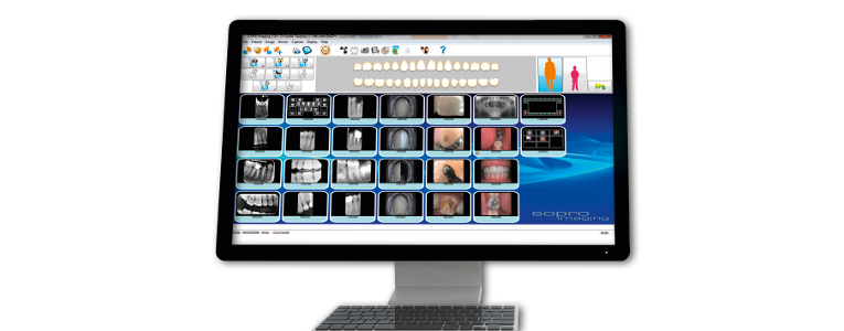 Digitalización de la Cámara intraoral Sopro 617