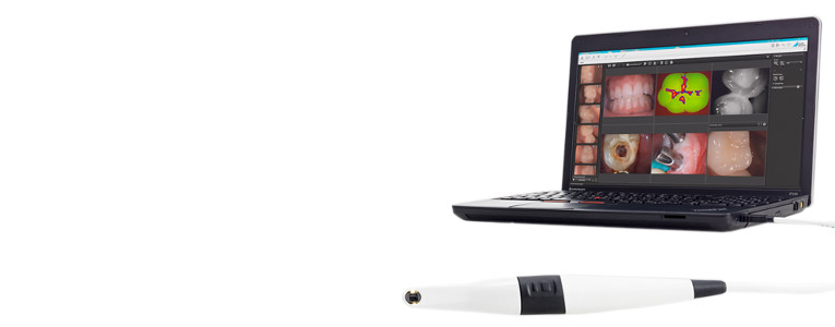 Conexión USB de la Cámara intraoral VistaCam iX HD Dürr Dental