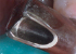 Toma intraoral con la Cámara intraoral VistaCam iX HD Dürr Dental