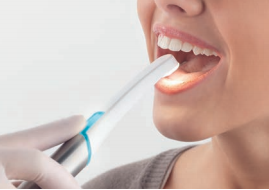 Cámara intraoral C-U2: HD VISION