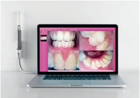 Cámara intraoral C-U2: PLUG & PLAY