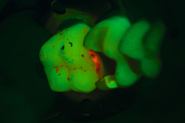 Microscopio dental EXTARO 300 Zeiss: Modo Fluorescence