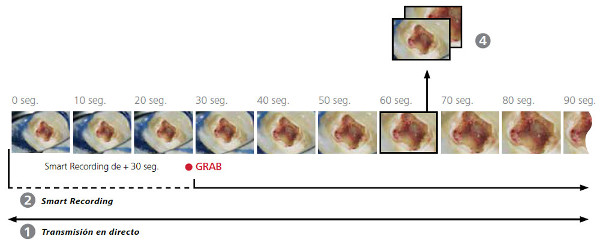 Microscopio dental OPMI Pico MORA Zeiss: Grabación con cámara