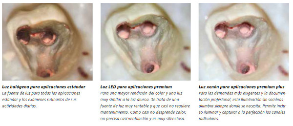 Microscopio dental OPMI Pico MORA Zeiss: Concepto de Iluminación