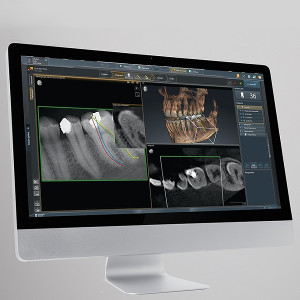 Panorámico ORTHOPHOS S 2D Dentsply Sirona: Vista de un escaneado