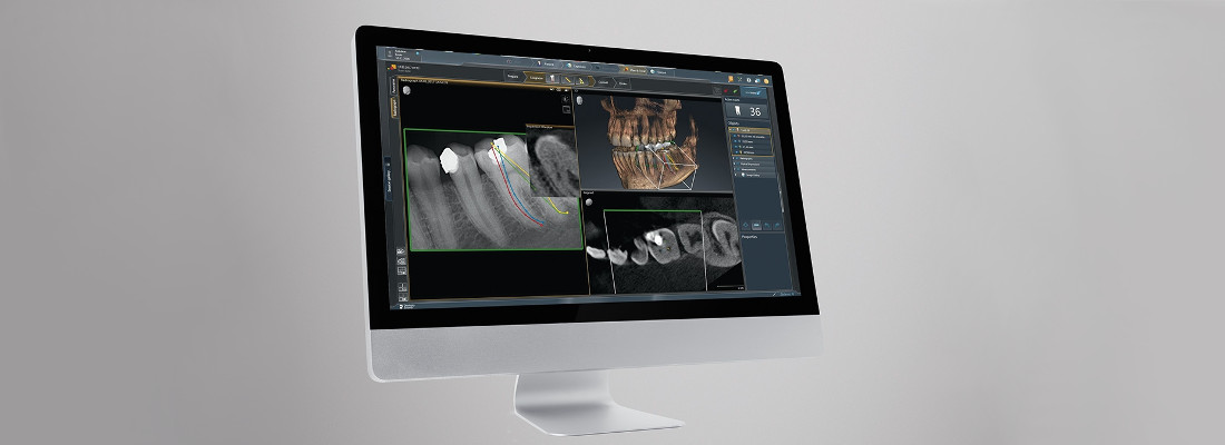 Panorámico ORTHOPHOS S 2D Dentsply Sirona: Vista de un escaneado