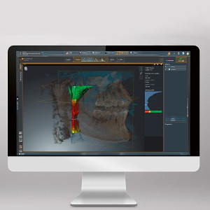 Panorámico ORTHOPHOS S 2D Dentsply Sirona: Software
