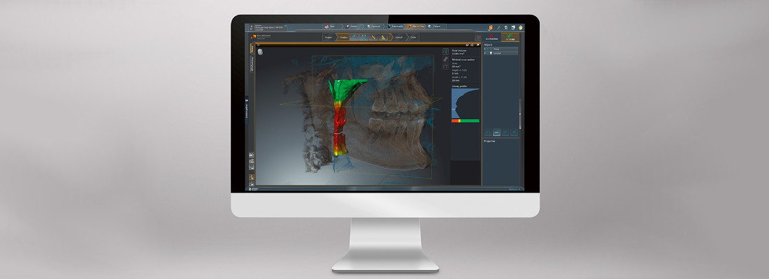 Panorámico ORTHOPHOS S 2D Dentsply Sirona: Software