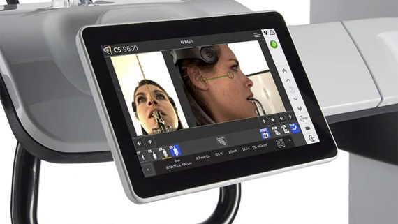 Panorámico CS 9600 Carestream: Colocación sencilla para mayor precisión