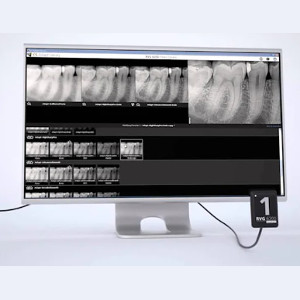 Sensor intraoral CS 6200 rvg: vídeo