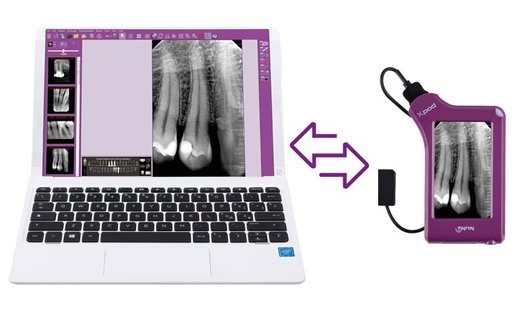 Sensor intraoral X-Pod: El dispositivo más versátil y moderno del mercado