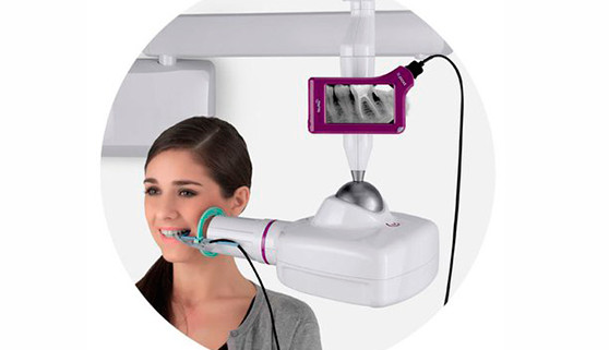 Sensor intraoral X-Pod: Sensor de alta definición