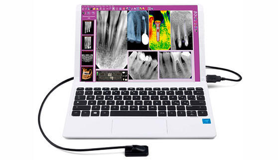 Sensor intraoral ZEN-X HD: principales ventajas