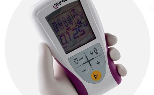 Aparato de Rayos X dental RXDC: Mando inalámbrico