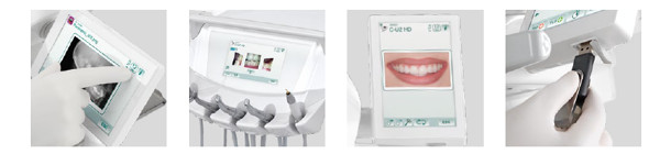Sillón dental R7 Cefla: pantalla