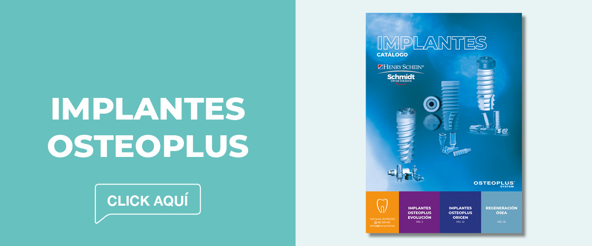 Implantes Osteoplus