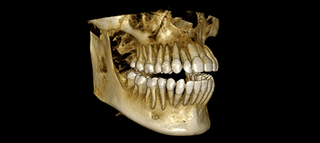 Panorámico CS 8200 3D Carestream: Resultado de las radiografías