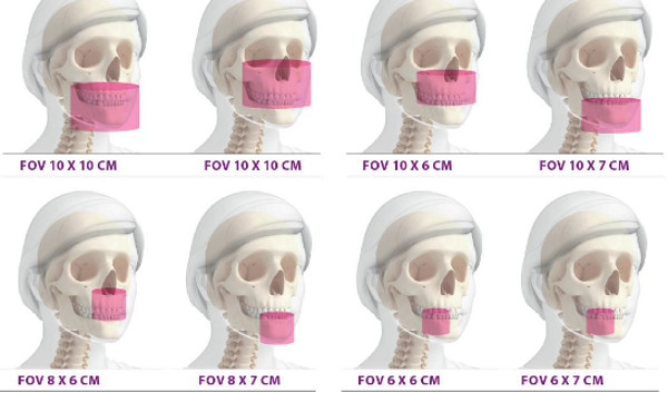 Panorámico HYPERION X5 3D/2D: Sistema 3D MultiFOV