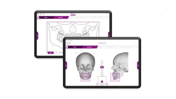 Panorámico HYPERION X5 3D/2D: Plug & Play. Apps disponibles para iPad