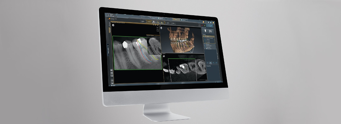 Panorámico ORTHOPHOS SL 3D Dentsply Sirona: Vista de un escaneado