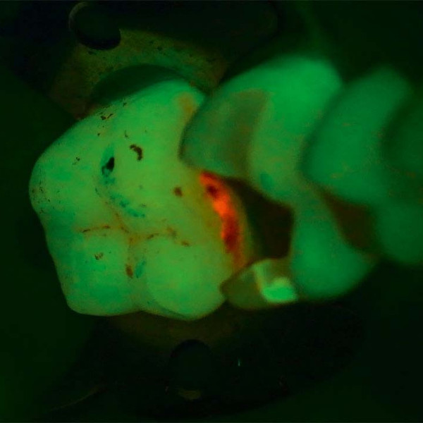 Fluroescence Mode