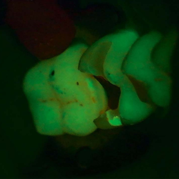 Fluroescence Mode